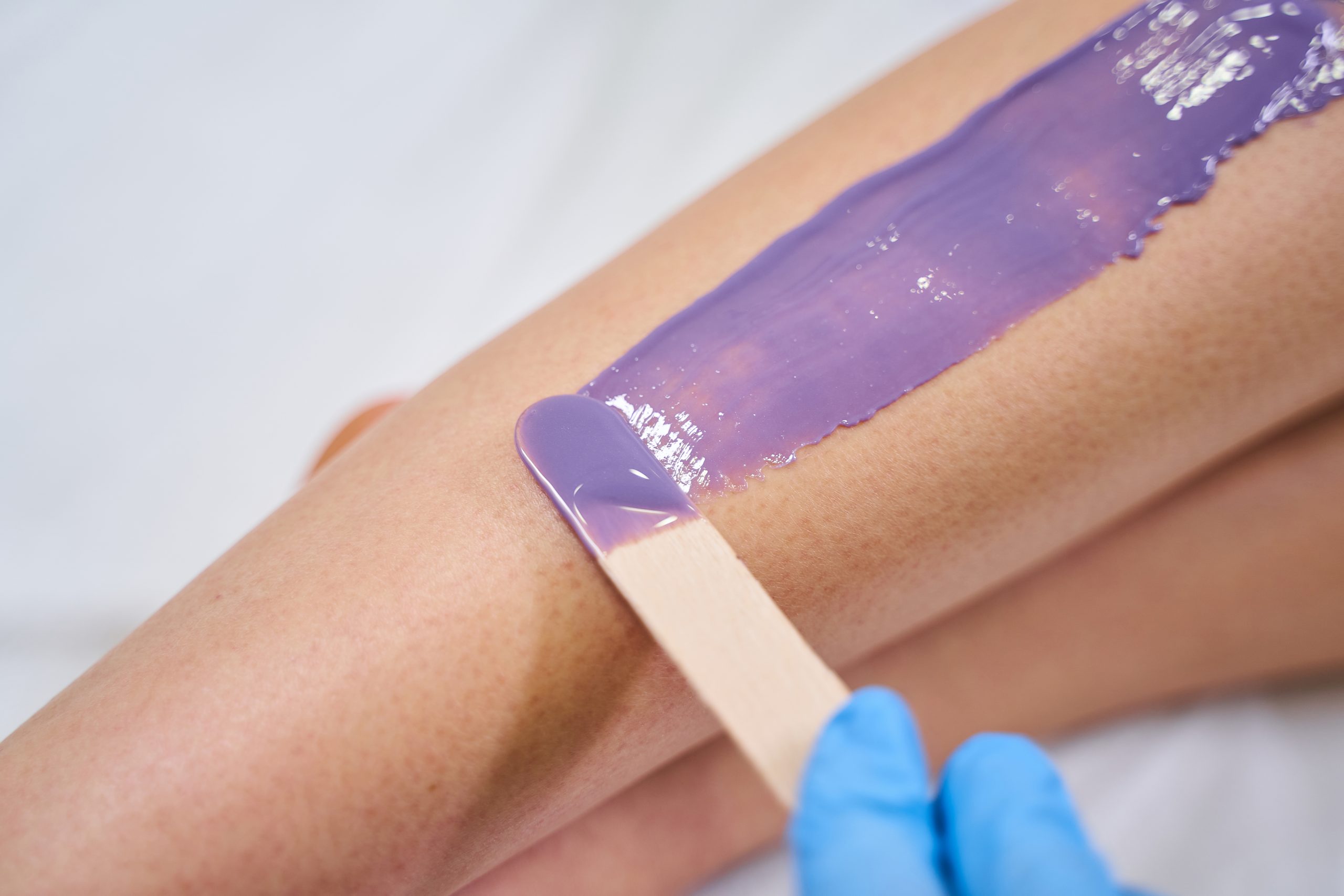 Popular problem. Female person holding wooden stick while working with wax for depilation